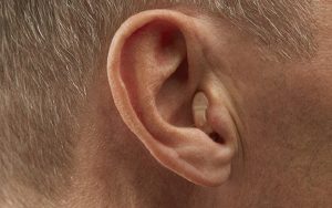 Completely-In-The-Canal Hearing Aids