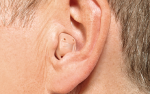 In The Canal Hearing Aids In The Canal Hearing Aids