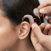 What is a Cochlear Implant? A Comprehensive Guide to Restoring Hearing